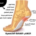 أفضل الأحذية لعلاج اللفافة الأخمصية والفلات فوت